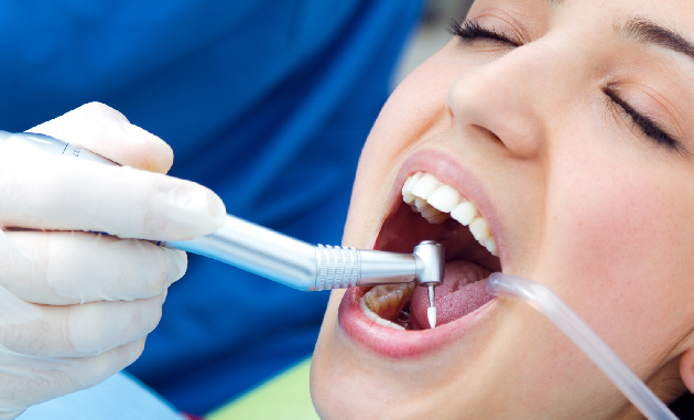 Limpieza Dental Profesional